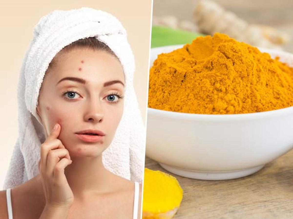 What is turmeric face mask good for